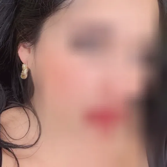 Lilly, 37